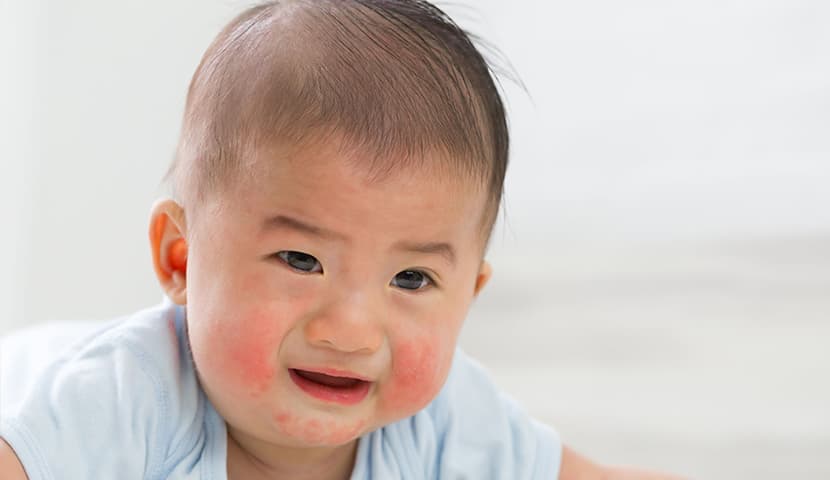 兒童護(hù)膚品激素、抗感染類(lèi)藥物測(cè)試